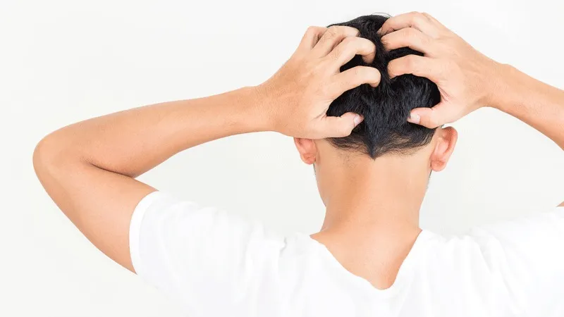 What Causes Itching After Hair Transplant