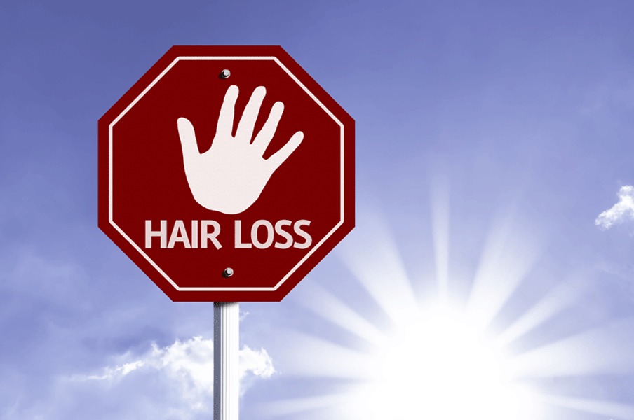 Hair Transplant Sun Exposure - Erdem Clinic