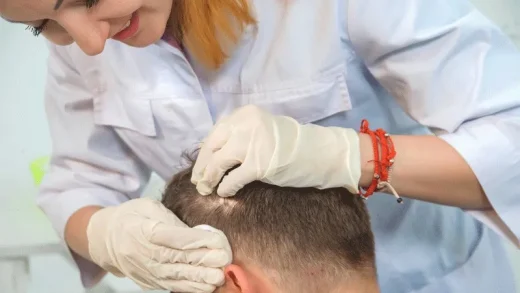 Health Tourism for Hair Transplant in Turkey