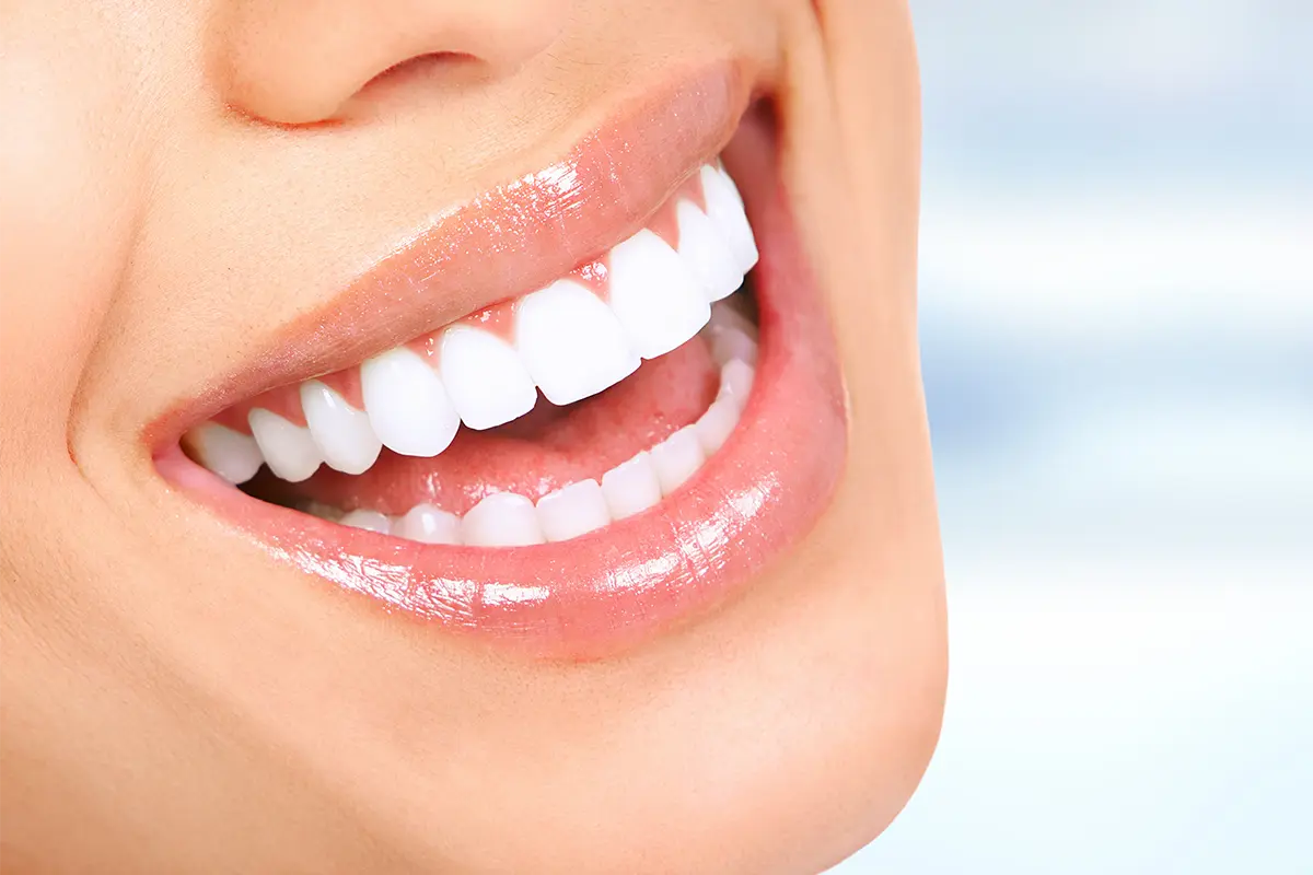 smile design cost in istanbul | Dr Anahita Bahar