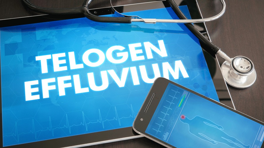 Telogen Effluvium: Know Why!
