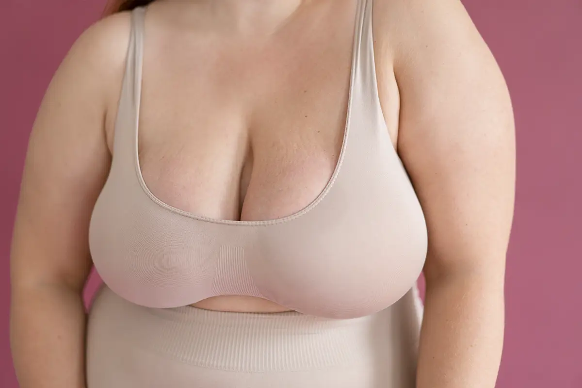 Saggy Boobs After Weight Loss - What can I do? Ask the Expert