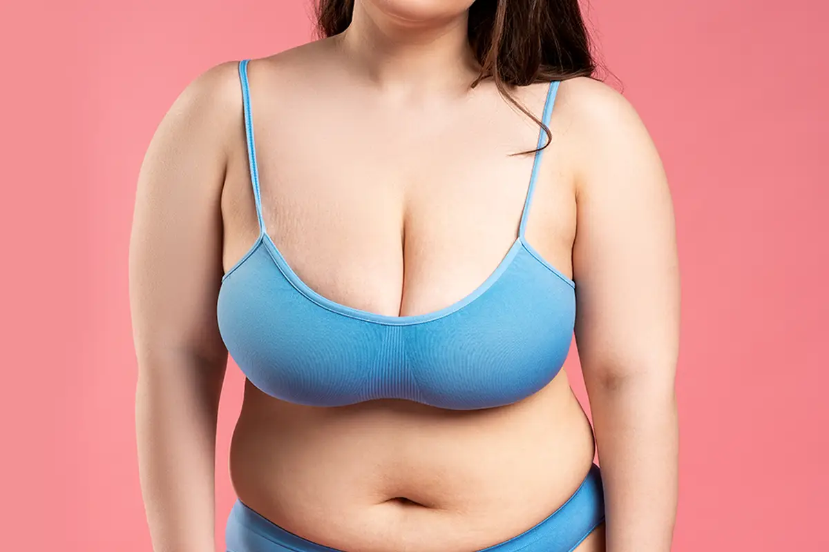 Recovery Tips After a Breast Reduction